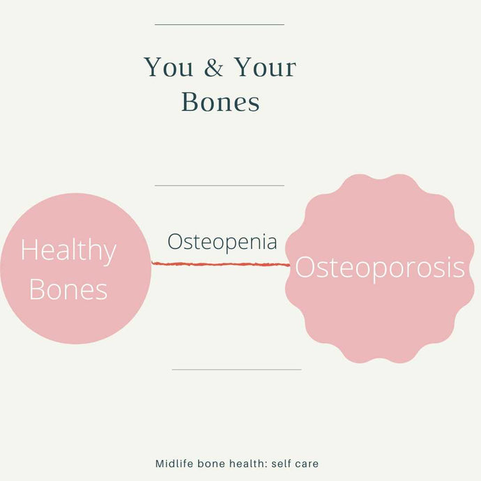 Bone density and why it is important for the future health of your bones